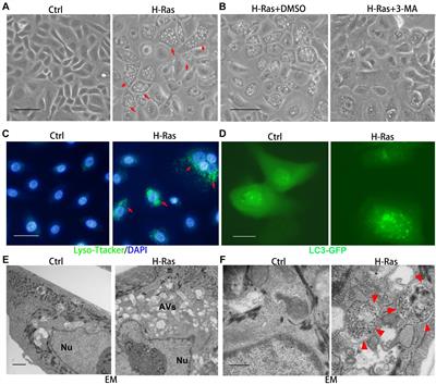 Inhibition of Calcineurin/NFAT Signaling Blocks Oncogenic H-Ras Induced Autophagy in Primary Human Keratinocytes